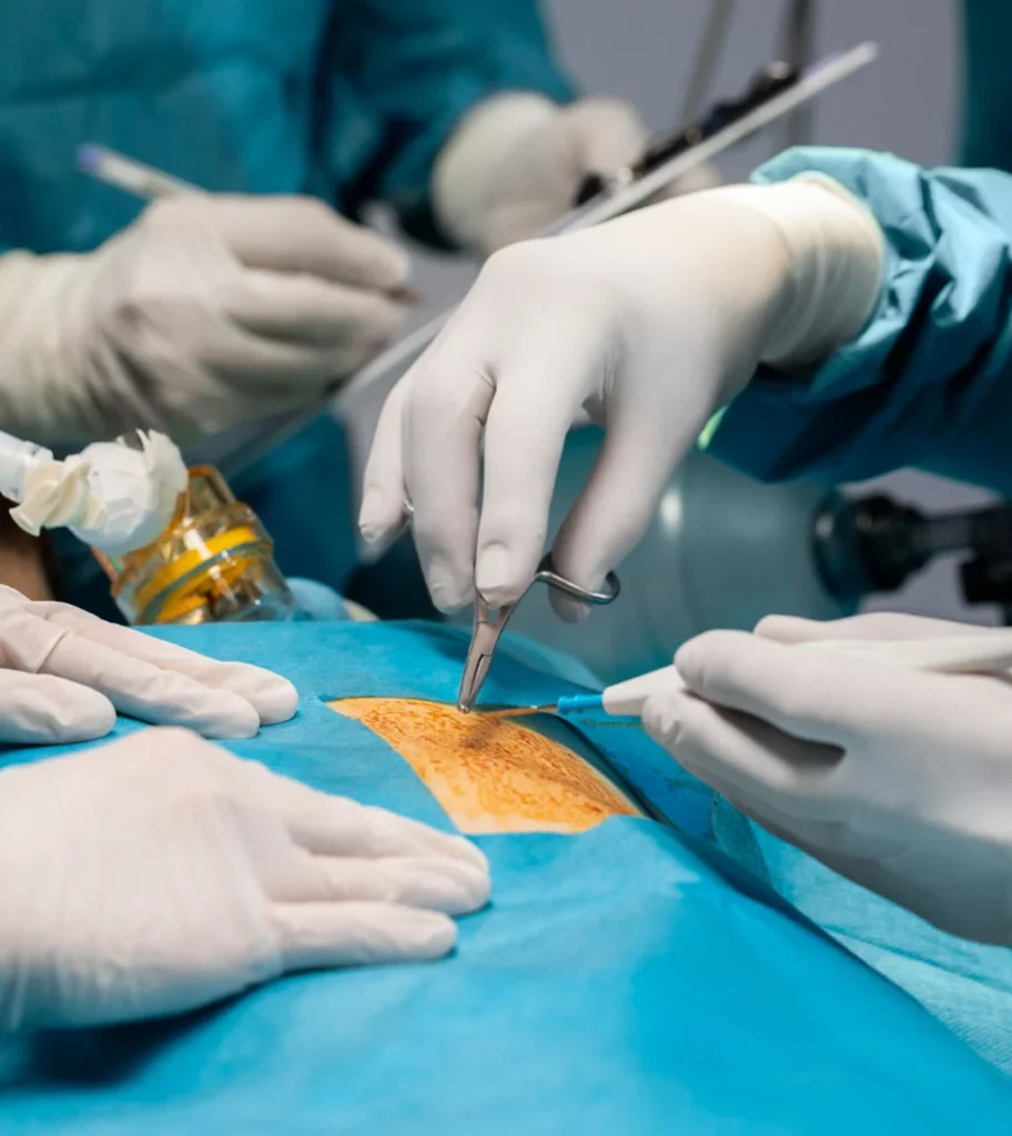 Skin Cancer Removal Surgery